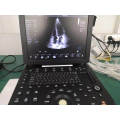 4D Color Ultrasound Doppler Probe Machine